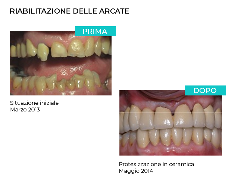 Chirurgia orale