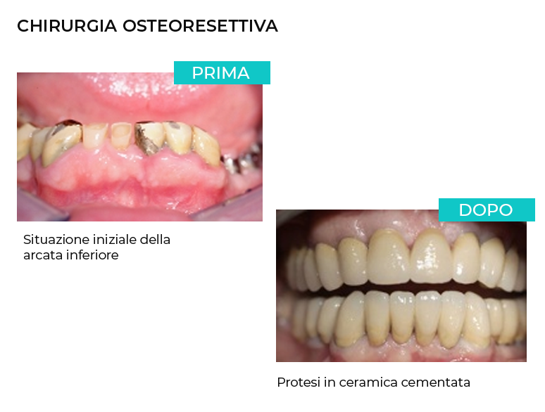 Intervento chirurgia orale